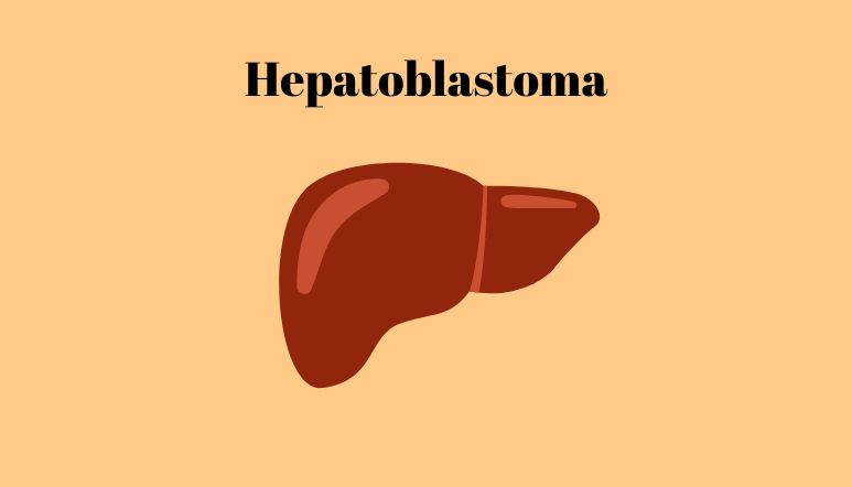 Illustration: Hepatoblastoma