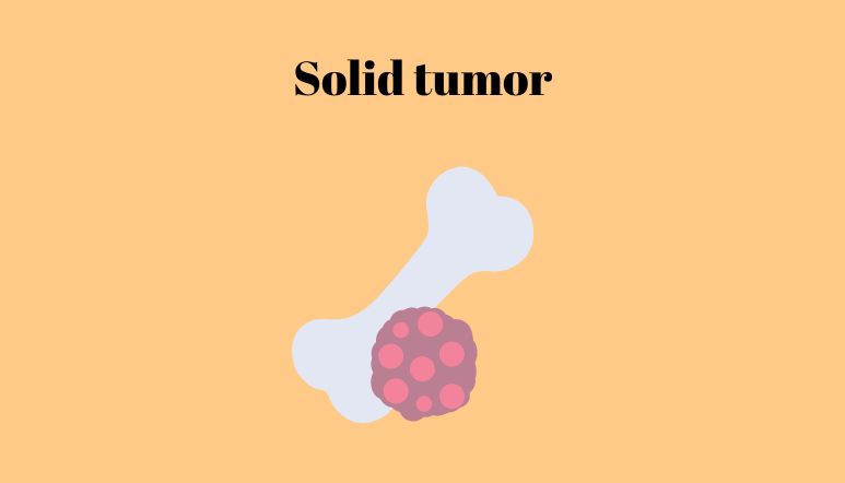 Illustration: Solid tumours